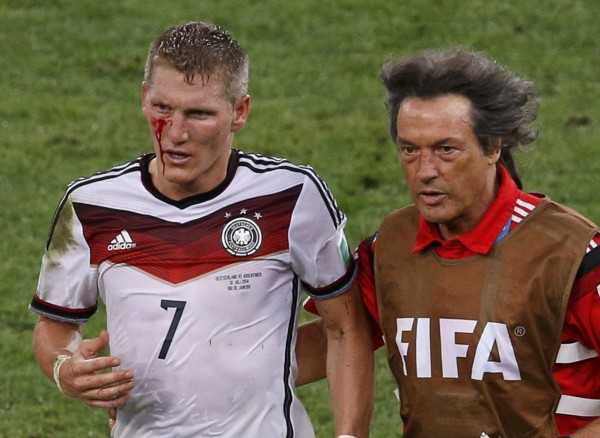 Bastian Schweinsteiger bleeding from his face, in the World Cup final