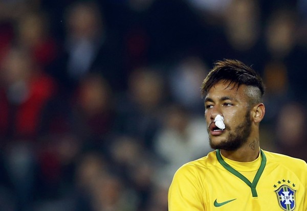 Neymar bleeding from his nose